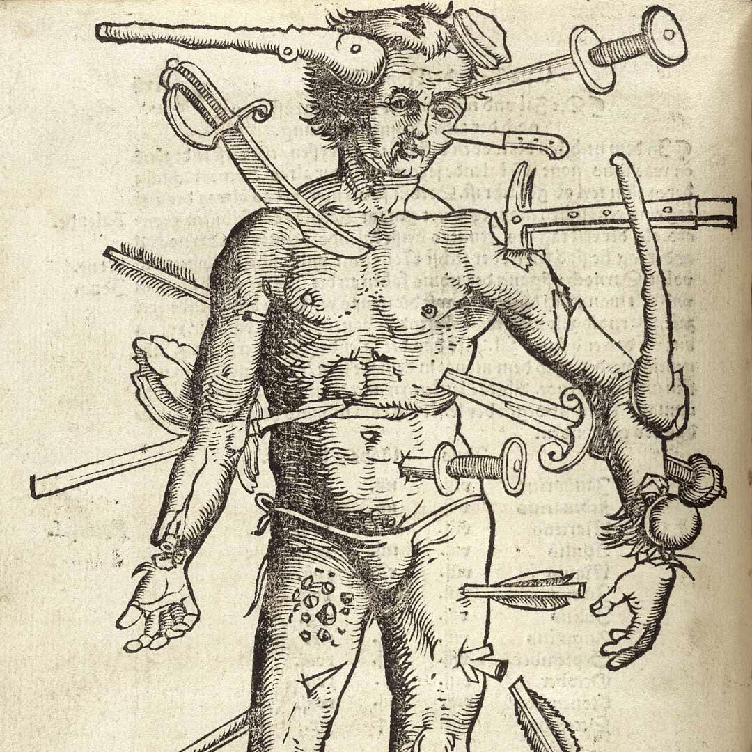 KIDNEY-STONE-BULL-PEN